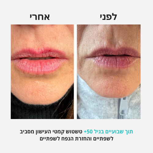 <h2>תוצאות שלכן ❤️</h2>