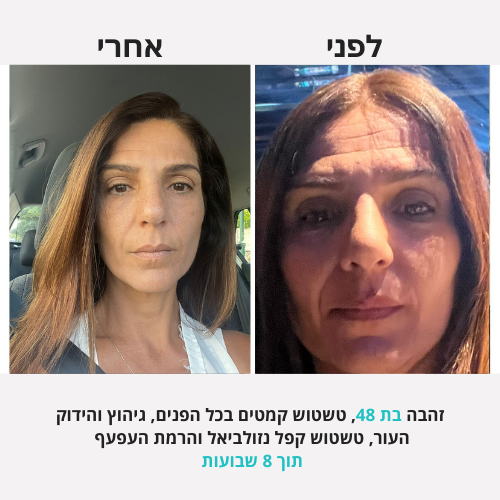 <h2>תוצאות שלכן ❤️</h2>
