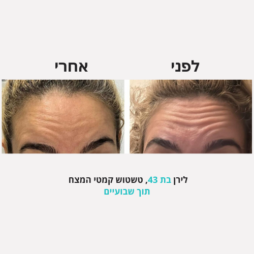 <h2>תוצאות שלכן ❤️</h2>
