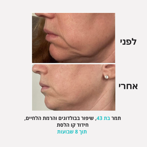 <h2>תוצאות שלכן ❤️</h2>