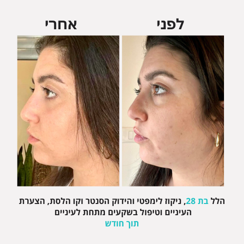 <h2>תוצאות שלכן ❤️</h2>