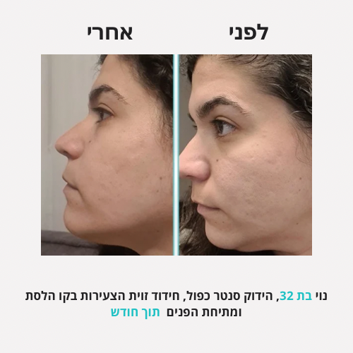 <h2>תוצאות שלכן ❤️</h2>