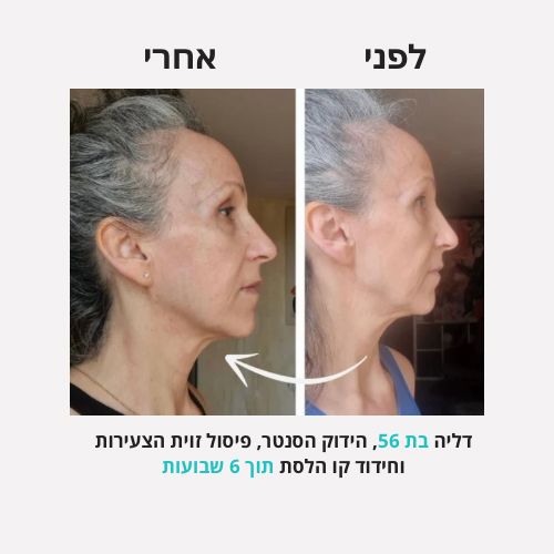 <h2>תוצאות שלכן ❤️</h2>
